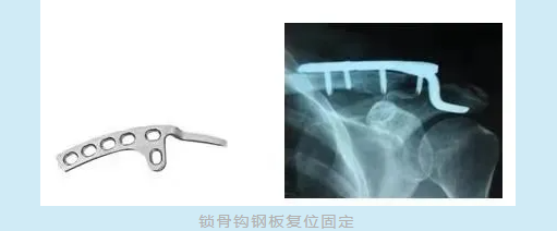 微信图片_20210311101342
